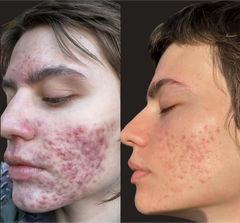 Results Accelerator Duo