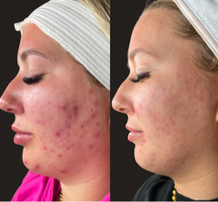 Results Accelerator Duo