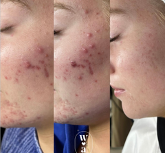 Results Accelerator Duo