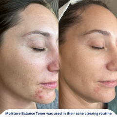 Moisture Balance Toner