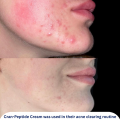 Cran-Peptide Moisturizer