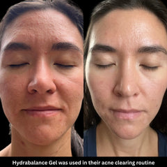 Hydrabalance Gel