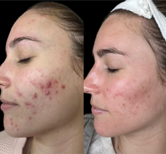 Results Accelerator Duo