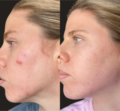 Results Accelerator Duo