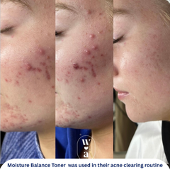 Moisture Balance Toner