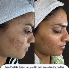 Cran-Peptide Moisturizer