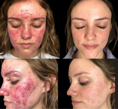 Results Accelerator Duo