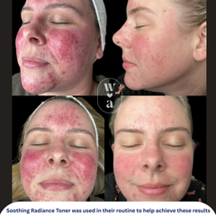 Soothing Radiance Toner