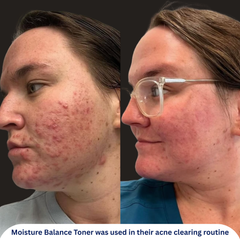 Moisture Balance Toner