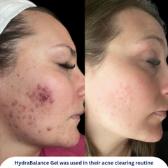 Hydrabalance Gel
