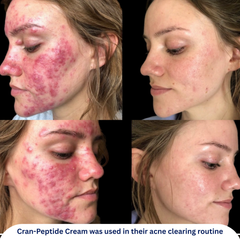 Cran-Peptide Moisturizer