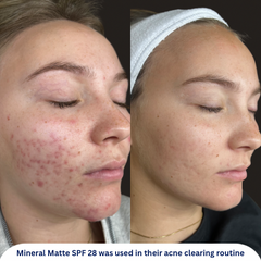 Mineral Matte SPF 28