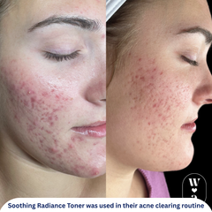 Soothing Radiance Toner