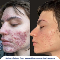 Moisture Balance Toner