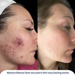 Moisture Balance Toner