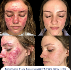 Barrier Balance Creamy Cleanser